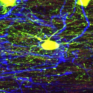Green Stem Cells in the Injured Brain